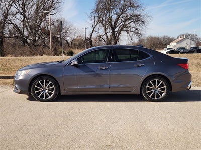 2018 Acura TLX 3.5L (A9)