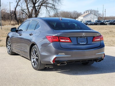 2018 Acura TLX 3.5L (A9)